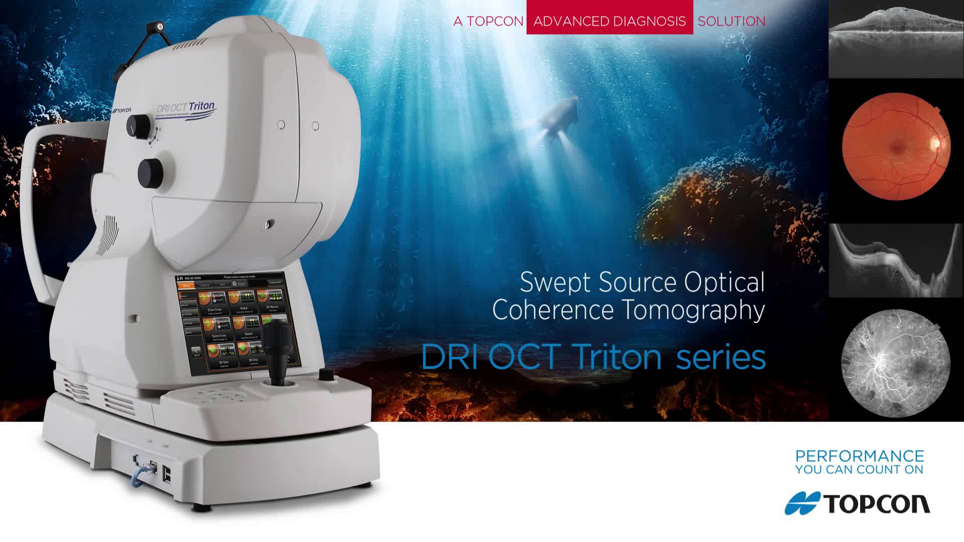 Advanced ophthalmology diagnostic eye scanning technology